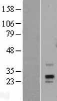 PRPS1L1 Human Over-expression Lysate