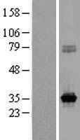 KCNRG Human Over-expression Lysate
