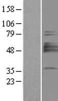 SIAT4A (ST3GAL1) Human Over-expression Lysate