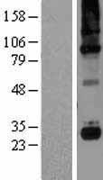 C1QC Human Over-expression Lysate