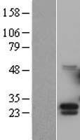 G CSF (CSF3) Human Over-expression Lysate