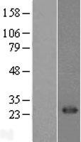 CD8A Human Over-expression Lysate
