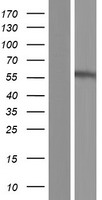 P2X2 (P2RX2) Human Over-expression Lysate
