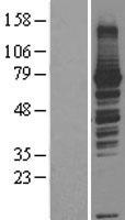 RASGRP3 Human Over-expression Lysate