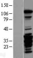 FAK (PTK2) Human Over-expression Lysate