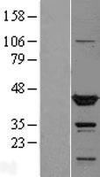 TTL Human Over-expression Lysate