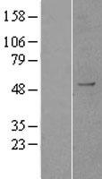 KDM1B Human Over-expression Lysate
