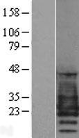 PMP22 Human Over-expression Lysate