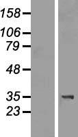 TIPRL Human Over-expression Lysate