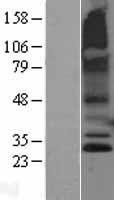 RNF182 Human Over-expression Lysate
