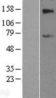 SLC39A12 Human Over-expression Lysate