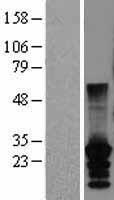 CT45A2 Human Over-expression Lysate