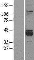 PPM1K Human Over-expression Lysate