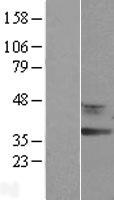 RDH12 Human Over-expression Lysate