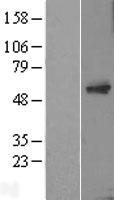 TC2N Human Over-expression Lysate