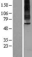 TAS1R2 Human Over-expression Lysate
