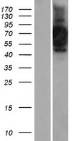 CNTF Receptor alpha (CNTFR) Human Over-expression Lysate
