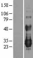 NFAM1 Human Over-expression Lysate