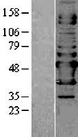 NAPRT1 (NAPRT) Human Over-expression Lysate
