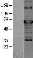 TOR1AIP2 Human Over-expression Lysate