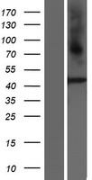 GPR73B (PROKR2) Human Over-expression Lysate