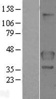 FLCN Human Over-expression Lysate