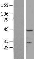 ZNF558 Human Over-expression Lysate