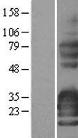 SYNPR Human Over-expression Lysate