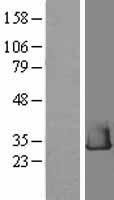 RHEBL1 Human Over-expression Lysate