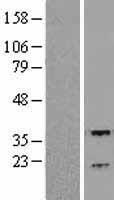 RGS3 Human Over-expression Lysate