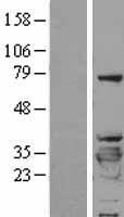 14-3-3 beta (YWHAB) Human Over-expression Lysate