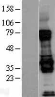 Livin (BIRC7) Human Over-expression Lysate