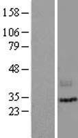 LIPH Human Over-expression Lysate
