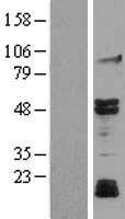 JNK3 (MAPK10) Human Over-expression Lysate