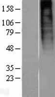 GPR73A (PROKR1) Human Over-expression Lysate