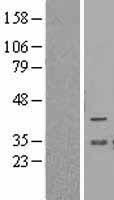 BCL2L12 Human Over-expression Lysate