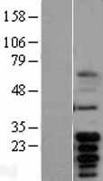 Bcl x (BCL2L1) Human Over-expression Lysate