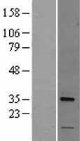 Nogo B receptor (NUS1) Human Over-expression Lysate