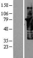 Cortactin (CTTN) Human Over-expression Lysate