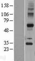 GPSN2 (TECR) Human Over-expression Lysate