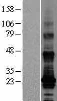 TM4SF19 Human Over-expression Lysate
