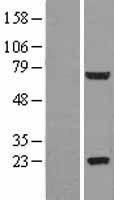 GLB1L2 Human Over-expression Lysate