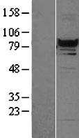 RFX3 Human Over-expression Lysate