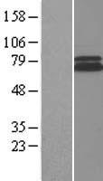 RAD1 Human Over-expression Lysate