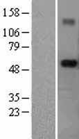 RNF89 (TRIM6) Human Over-expression Lysate