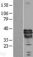 Apolipoprotein A V (APOA5) Human Over-expression Lysate