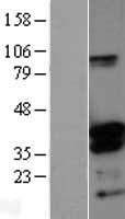 DNTTIP1 Human Over-expression Lysate