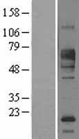 FCRL1 Human Over-expression Lysate