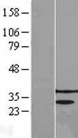 PRPK (TP53RK) Human Over-expression Lysate