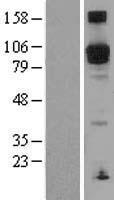 PDE5A Human Over-expression Lysate